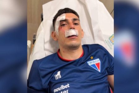 Ônibus do Fortaleza é atingido por bombas e pedras; seis jogadores são atingidos