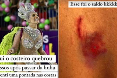 Influencer desfila com prego nas costas: “Só sentia o sangue escorrendo”