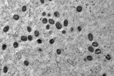 Mpox: Argentina põe em quarentena navio que deixou Brasil