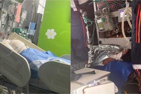 Sogra ateia fogo em adolescente enquanto ela dormia, no bairro de Campinas de Pirajá