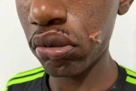 Barrocas: Homem é agredido com pá por companheira depois de chegar tarde em casa