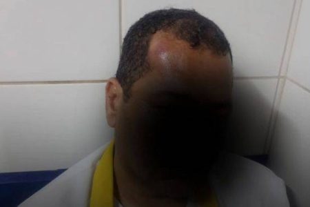 Motorista de ônibus é agredido por passageiro a caminho de São Tomé de Paripe