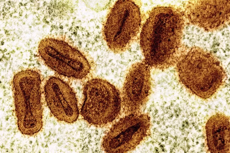 Brasil registra primeiro caso da nova cepa de Mpox