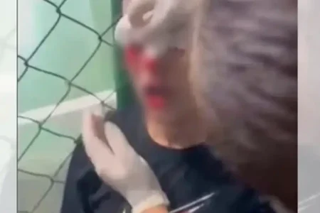 Explosão em vestiário fere jogador e cancela partida da Copa Rio Sul de Futsal