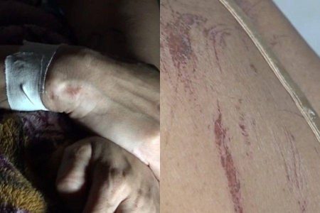 Mulher sobrevive após ser estrangulada e enterrada pelo ex-namorado em Itabuna Mulher sobrevive após ser estrangulada e enterrada pelo ex-namorado em Itabuna