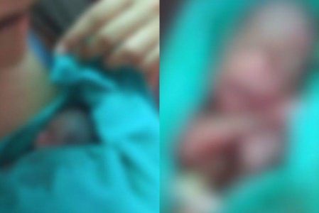 Bebê prematuro dado como morto chora dentro do caixão no Acre