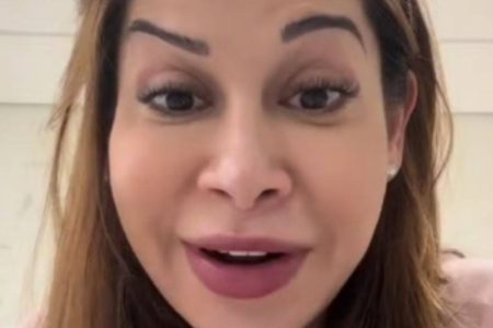 Maira Cardi relata erro em procedimento estético após aplicação de botox: “Ficou ridícula”