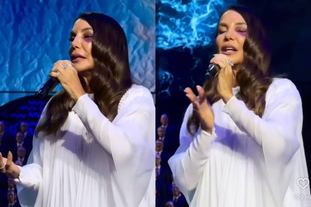 Ivete Sangalo faz primeira apresentação com olho roxo após desmaio