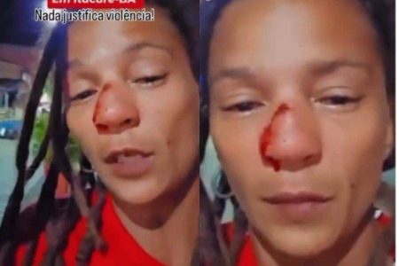 Ambulante denuncia ataque de turistas israelenses em Itacaré e diz ter sofrido fratura no nariz