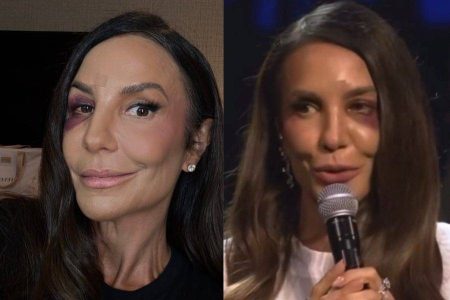 Ivete Sangalo comandará show do BBB 26 após cirurgia no rosto