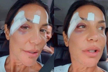 Ivete Sangalo passa por cirurgia após desmaio em Salvador