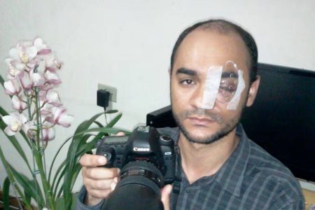 Supremo responsabiliza Governo de SP por cegueira de fotojornalista em protesto