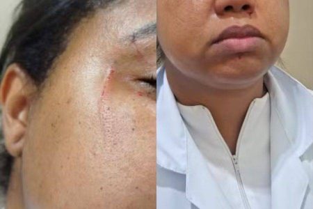 Acompanhante de paciente é suspeita de agredir três enfermeiras em hospital de Salvador