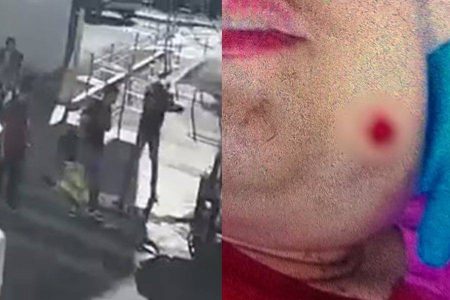 Jovem autista é baleada no rosto após sorrir para homem em terminal de Goiânia