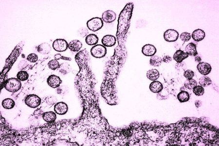 Espanha registra segundo caso de hantavírus ligado a surto em navio de cruzeiro