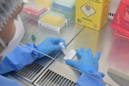 Brasil investiga dois casos suspeitos de Ebola após diagnósticos distintos em SP e no Rio