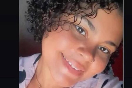 Mulher tem 50% do corpo queimado após companheiro atear fogo nela em Irecê