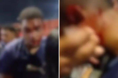 Motociclista é agredido em confusão após partida do Vitória no Barradão