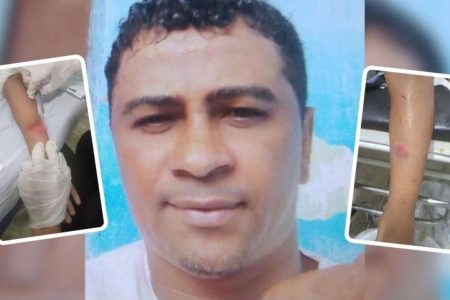 Crianças são esfaqueadas em Santa Bárbara; padrasto é o principal suspeito