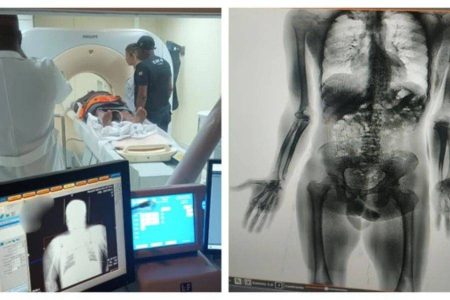 Scanner flagra dois presos tentando entrar com drogas no corpo em presídio na Bahia