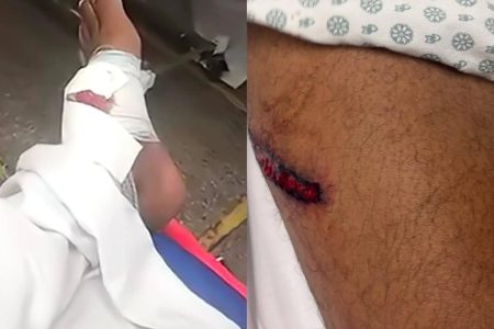 Funcionários de loja de material de construção são baleados durante entrega no Vale das Pedrinhas
