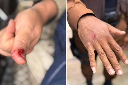 Macaco-prego de ex-deputado Marcell Moraes invade casas e deixa cinco feridos em Salvador