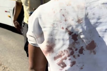 Briga entre motorista de ônibus e condutor de carro termina com três feridos em Brotas